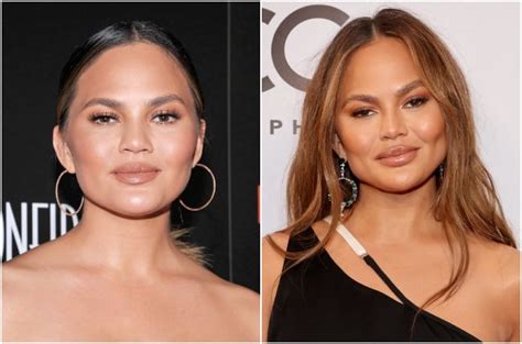 Celebrities Who Had Buccal Fat Removal: A Trend or a Timeless Transformation?