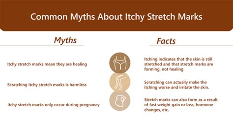 Do Stretch Marks Itch? Exploring the Mysteries of Skin and Sensation