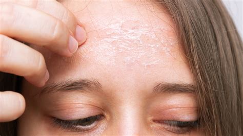 What Spa Treatment Involves Running Warm Oil on the Center of the Forehead? And Why Does It Feel Like a Cosmic Hug?